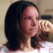 acid attack survivor film chhapaak review - Satya Hindi