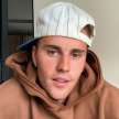 Popular youth singer Justin Bieber paralyzed on face - Satya Hindi