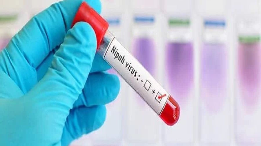 केरल में इस साल निपाह से दूसरी मौत, जानें कितना ख़तरनाक वायरस