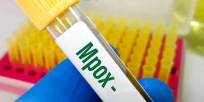 india reported first mpox case govt says no risk to public - Satya Hindi