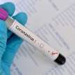 study finds hepatitis in corona affected children - Satya Hindi
