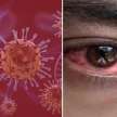 black fungus infected three children lost eyes in mumbai  - Satya Hindi