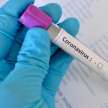 More than 83 per cent corona infected people below 60 years - Satya Hindi